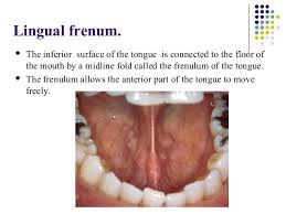 Floor Of The Mouth