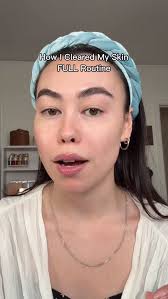 I quit using retinol and my skin cleared up?! This is a super long video  but I’m hoping this can help someone who needs it! Here’s everything I  use:, @panoxyl Acne Foaming Wash 10%, ...