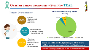 In 2020, nearly 300,000 new diagnoses and over 184,000. Sapien Biosciences October Is Ovarian Cancer Awareness Month Also