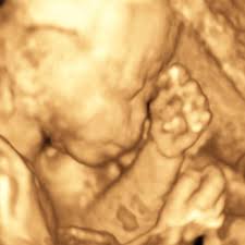 Check spelling or type a new query. A 4d Ultrasound Image Of The Fetus S Facial Features From 18 Download Scientific Diagram