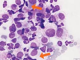 Image result for mastocytoma in dogs