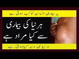 Abortion side effects & infertility in urdu/hindi | hamal zaya karne ke nuqsanat (top gynecologist). What Is Hernia And Its Causes In Urdu Hernia Kya Hai Ye Kab Hota Hai Aur Hernia Symptoms Urdu Surgery