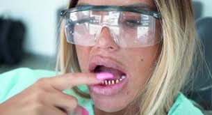 The right type of tooth extraction depends on the tooth's shape, size, position, and location in the mouth. Katie Price Fans Say Boyfriend Carl Has Destroyed His Teeth After Surgery