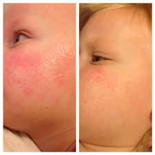 Pin On Facial Skincare