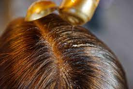 It originated in the united states during the 1960s, with its most recent iteration occurring in the 2000s. Use Oil To Nourish Your Hair Naturally