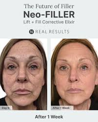 🔥🔥🔥I am thrilled to be attending this groundbreaking conference, where  we are poised to revolutionize the skincare industry! April 25th will be a  historic day with the unveiling of the Future of