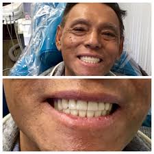 Ephraim Rollolazo Jr. DPD