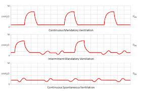 Http Www Icureach Com Downloads Courses Guide To Understand Mechanical Ventilation Waveforms Pdf
