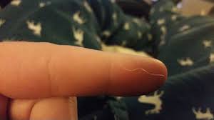 In support of the first function. Check Out This Crazy Long White Nose Hair Imgur