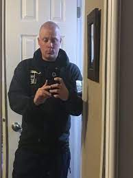 Hair loss can be a very sensitive topic. Smp Scalp Micropigmentation Thread Impact Of Hair Loss Forum