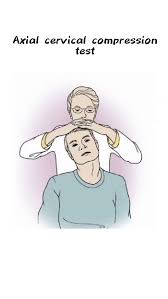 Image result for Pelvic Compression Test