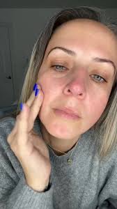 When I tell you, your skin will absolutely love you after applying this RoC  Skincare Hydration+ Serum to your face, I mean it! Packed with SEVEN types  of hyaluronic acids and collagen, it’s giving ...