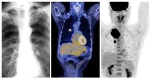 Petfirst's pet insurance coverage is easy to understand because it works like traditional health insurance coverage. Pet Scan Patient Information Portal Departmentof Radiology Uc Davis Health