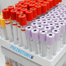As a professional phlebotomy technician, there are certain supplies that are critical to have available to perform your job. What S The Most Commonly Used Phlebotomy Equipment Phlebotomyu