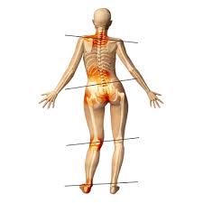 Image result for Functional Leg Length Discrepancy