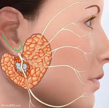 Image result for Paropsia