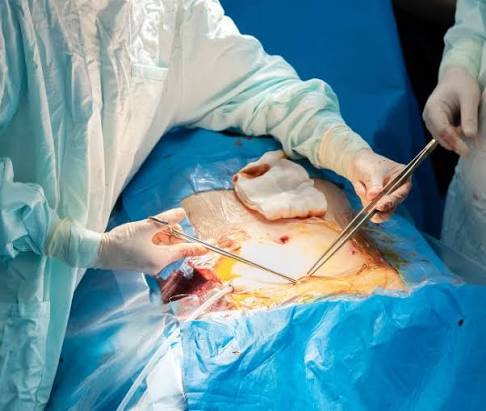 Advanced surgical oncology care at Profrea