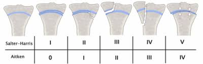 We would like to show you a description here but the site won't allow us. Unfallchirurgie Flashcards Quizlet