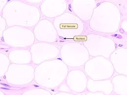 Pin On Connective Tissue