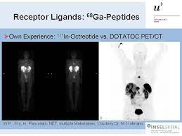Maybe you would like to learn more about one of these? Petct In Oncology Pet Tracers Other Than Fdg