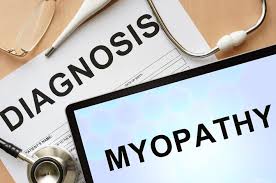 Image result for Myopathy