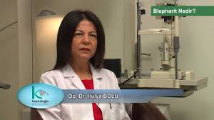 Goz Kapaginda Iltihap Blepharit Nedir Ve Tedavisi Izmir Kaskaloglu Goz Hastanesi Youtube Youtube Gozler Saglik
