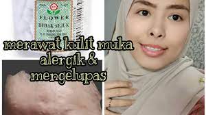 Maybe you would like to learn more about one of these? Rawat Kulit Mengelupas Pedih Alergik Dgn Bedak Sejuk Harga Murah Youtube