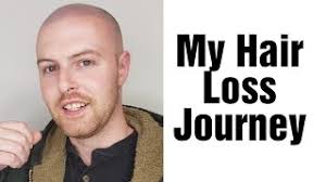 Ian Dennis, Scalp Micropigmentation Artist Houston & Austin Texas