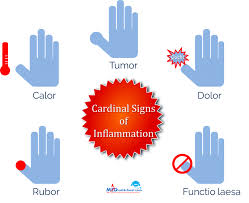 Cardinal Signs Of Inflammation Signs Of Inflammation Inflammation Health Facts