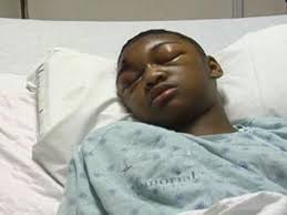 Rock Thrown at School Bus Lands Girl In ICU