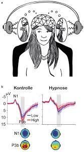 Neurowissenschaftliche Befunde zu hypnotischen Suggestionen | SpringerLink