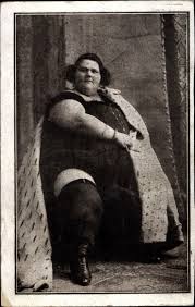 L'homme le plus gros du monde va être opéré. Ansichtskarte Postkarte Teresina La Plus Grosse Femme Akpool De