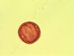 Image result for Pentarhopalopilia umbellulata