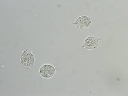 Image result for trichomonas images