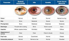 Rosh Review Optometry Education Eye Facts Opthalmic Technician