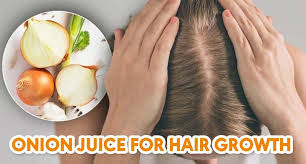 No, that wasn't a typo. People Are Trying Onion Juice For Hair Growth Why Don T You
