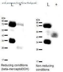 This dye is a tandem fluorochrome of bd horizon bv421 with an ex. Cd63 Antibody 53 Products In Validated Antibody Database 131 Cited In The Literature 422 Total From 31 Suppliers