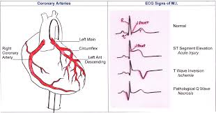 Illustration Ecg Guru Instructor Resources