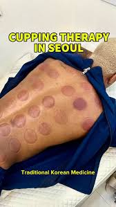 Ever tried Korean medicine while in Seoul?, I visited **Yonghada Korean  Medicine Clinic** @yonghadaclinic_en in Myeongdong for a full wellness  reset—complete with a body checkup, blood pressure + ...