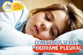 El derrame pleural es la filtración de líquido hacia el espacio pleural. La  pleura es la fina membrana que cubre el pulmón (pleura visceral) y la pared  torácica (pleura parietal), el espacio