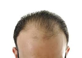 يفضل العديد من الرجال فى الوطن العربى الشعر القصير ،وتتنوع التصفيفات الخاصة بالشعر القصير سواء كان قصير جدا أو قصير على طبيعتة. Ù„Ù„Ø±Ø¬Ù„ Ø´Ø¹Ø±Ùƒ Ø®ÙÙŠÙ 6 Ø­ÙŠÙ„ ØªØ¬Ø¹Ù„Ù‡ Ø£ÙƒØ«Ø± ÙƒØ«Ø§ÙØ© Ù…ØµØ±Ø§ÙˆÙ‰