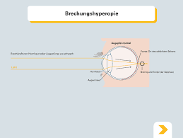 Weitsichtigkeit Ursachen Symptome Und Behandlung