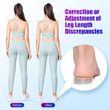 Image result for Functional Leg Length Discrepancy