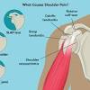 Although three ligaments protect and surround the shoulder joint, most of its stability comes from the powerful muscles and tendons of the rotator cuff. 1