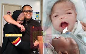 Bakal menjalani pembedahan di united kingdom tidak lama lagi. Ainul Dah Buka Mata Comel Sangat Dia Sudah Sedarkan Diri Ini Wajah Terkini Ainul Mardhiah Selepas Pembedahan Gempak