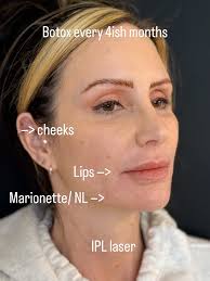 Alpine Aesthetics and Wellness (@alpineaestheticsandwellness) · Reno, NV