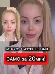 Бръчки и ботокс: Как да се справим с тях