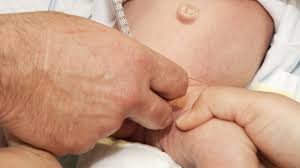 Por Una Circuncision Casera Muere Un Bebe De Cinco Meses En Italia Bbc News Mundo