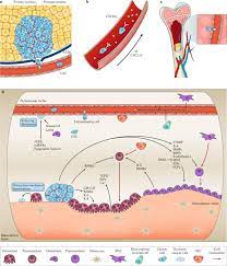 One in seven men in the united states will receive a prostate cancer diagnosis during his lifetime. Translational Models Of Prostate Cancer Bone Metastasis Nature Reviews Urology