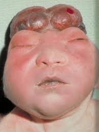 Kecacatan at indonesian => english of explained: Bayi Dan Anak Www Hamidarshat Net